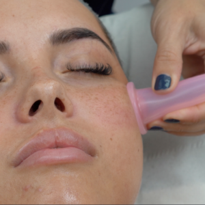 facial-cupping-1024x1024 Online Kurs Schröpfen Massage Gesicht