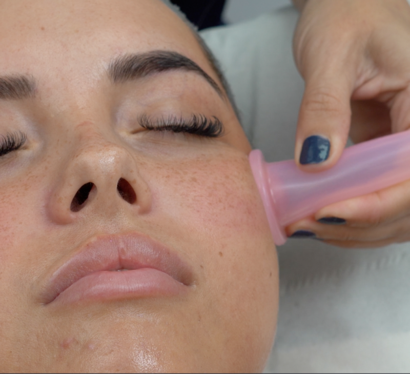 facial-cupping-1024x1024 Online Kurs Schröpfen Massage Gesicht