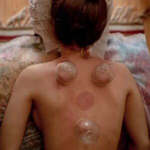Body-Cupping-Massage-1024x1024-1-e1754294323484-600x545 Online Kurs Schröpfmassage Körper (Cupping)